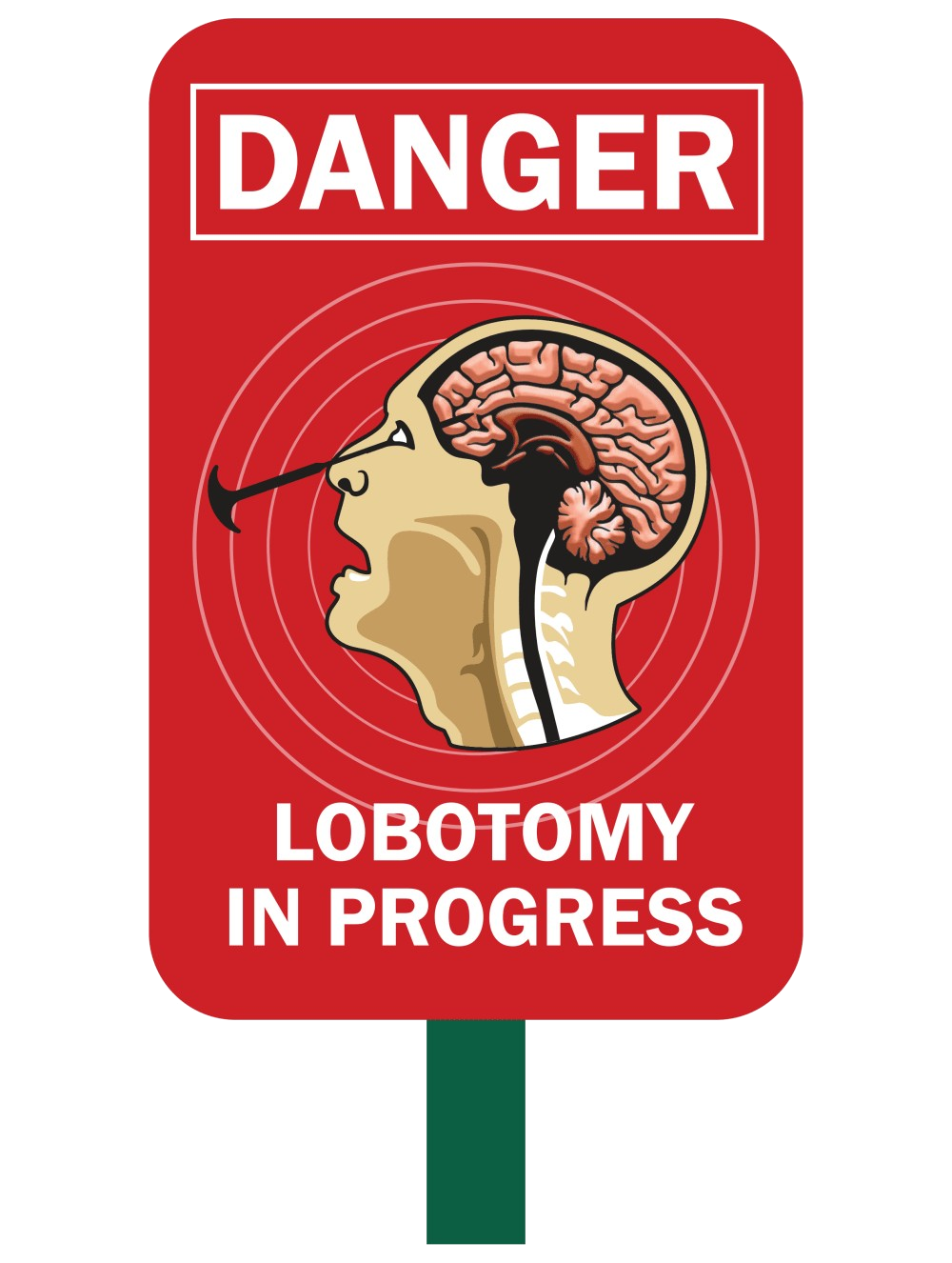 Lobotomy in Progress Safety Sign