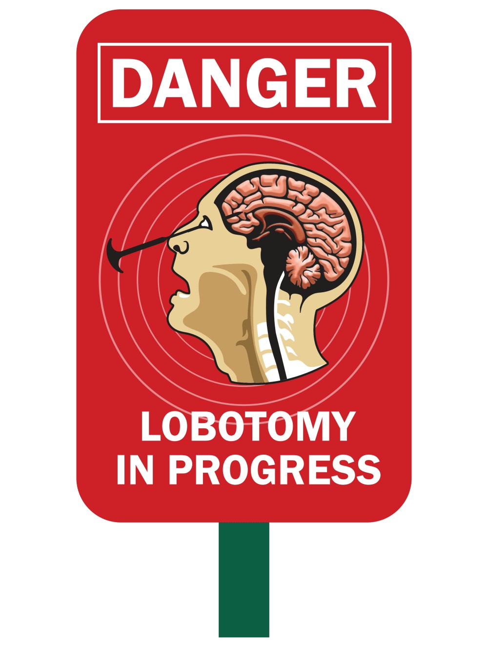 Lobotomy in Progress Safety Sign